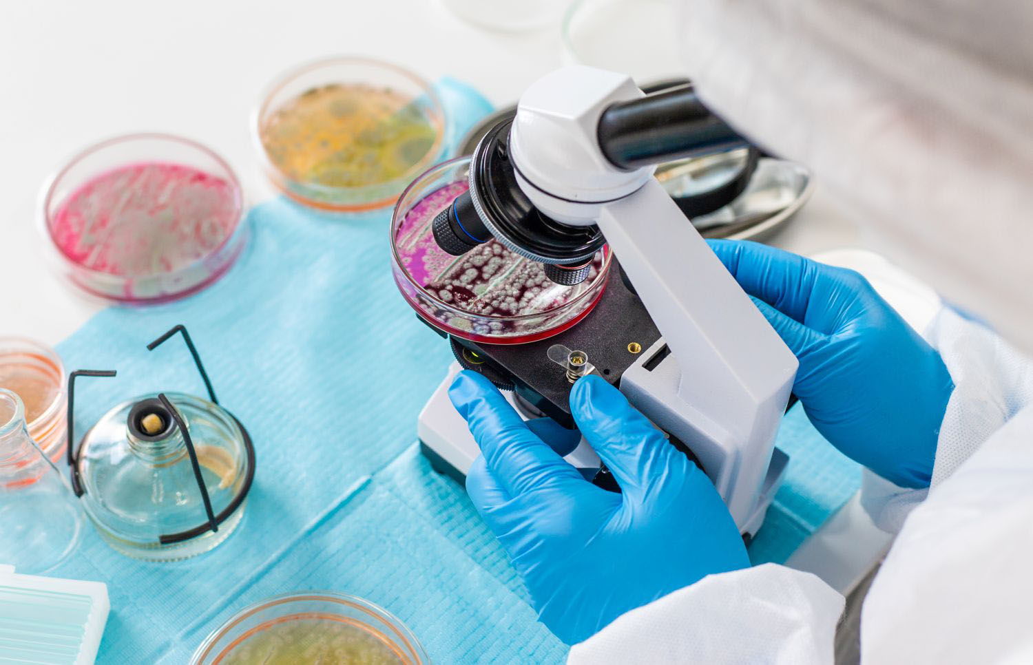 Petri dishes being examined in a laboratory 